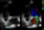 Two small side-by-side grey monitor-style images, the right one with blue and red colour overlay